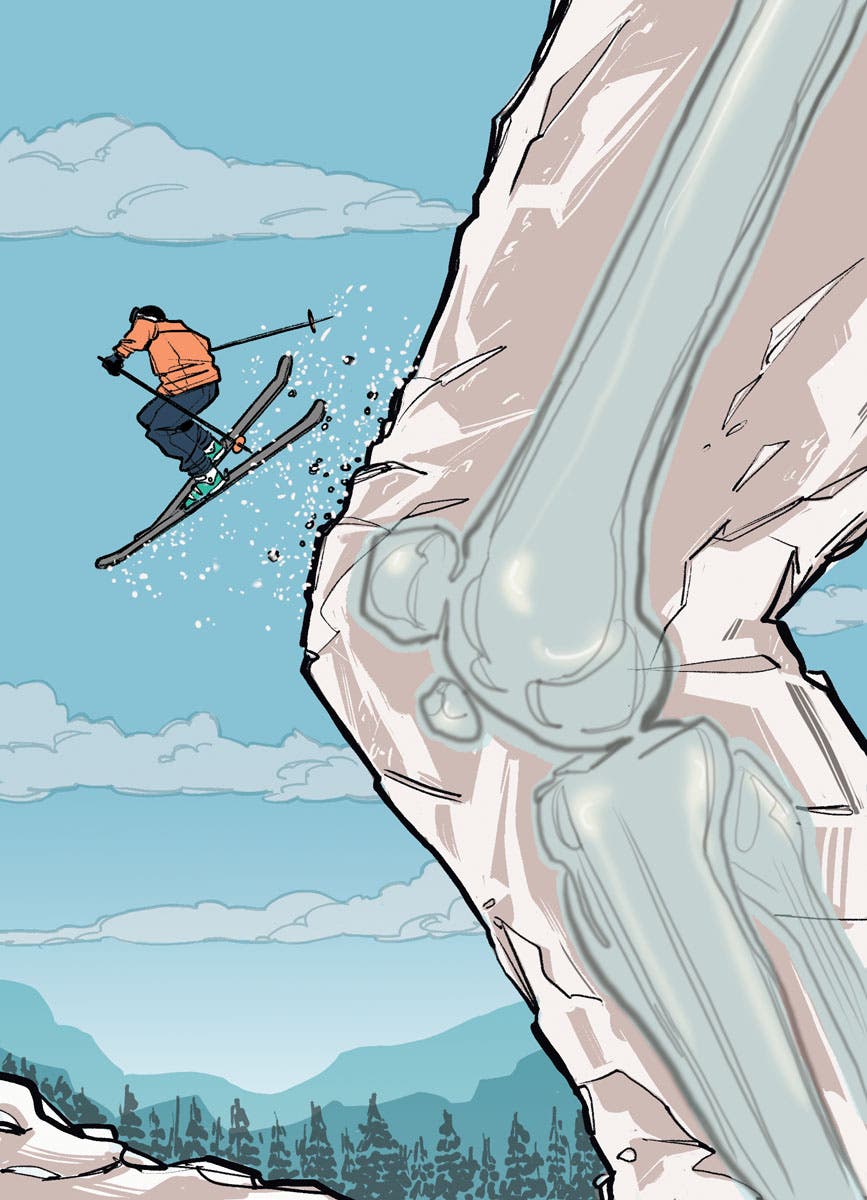 SKI1017_TRE_KNEE None