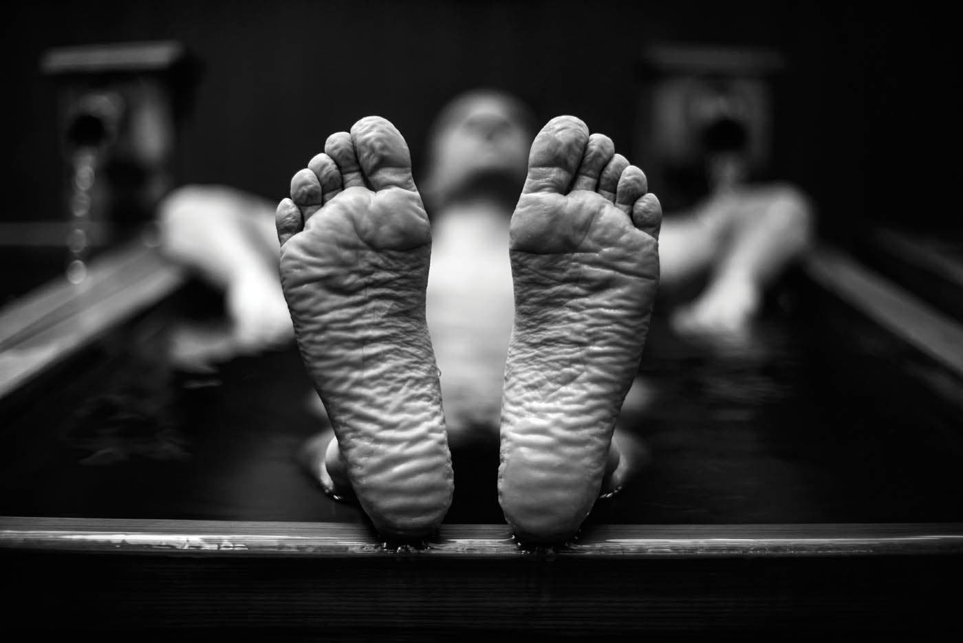 Hours of onsen-soaking lead to pruned-up feet